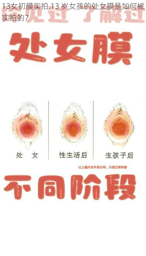 13女初膜实拍,13 岁女孩的处女膜是如何被实拍的？