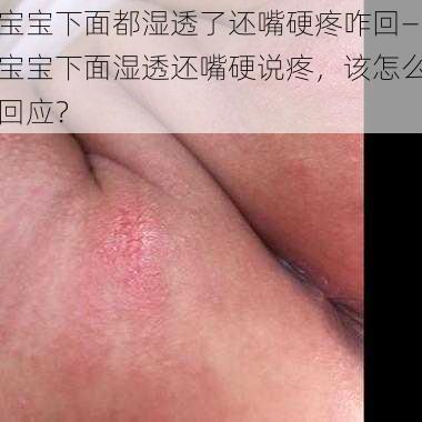 宝宝下面都湿透了还嘴硬疼咋回—宝宝下面湿透还嘴硬说疼，该怎么回应？